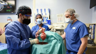 US-Patient zwei Monate nach erster Schweineherz-Transplantation gestorben