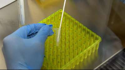 RKI startet umfangreiche Antikörperstudie zum Coronavirus