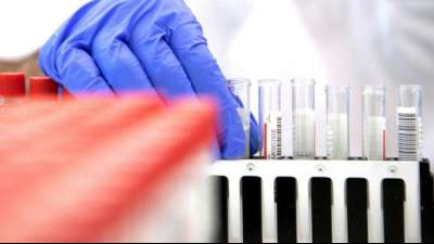 PCR-Test: Kein Anspruch durch Warnmeldung auf Corona-App