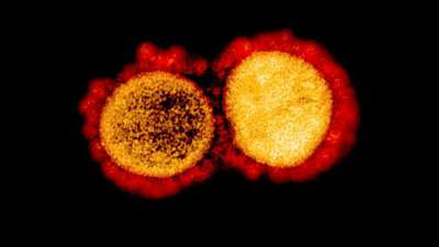 US-Forscher entwickeln neuen Coronavirus-Stamm für Impfstoff-Tests