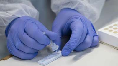 Erneut mehr als 9000 Corona-Neuinfektionen in Deutschland