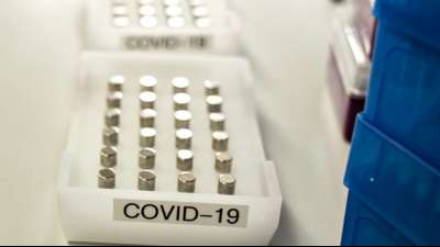 Studie: Vermehrung des Coronavirus l&auml;sst sich mit Crispr-Methode stoppen