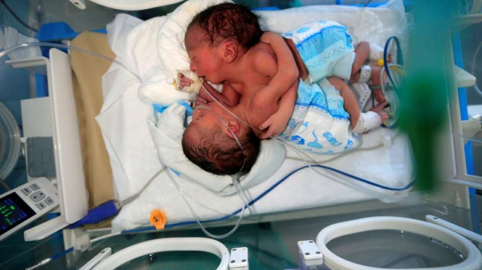 Siamesische Zwillinge aus dem Jemen werden in Jordanien operiert 