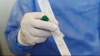 Slowakei versch&auml;rft Grenzkontrollen aus Furcht vor Coronavirus-Varianten