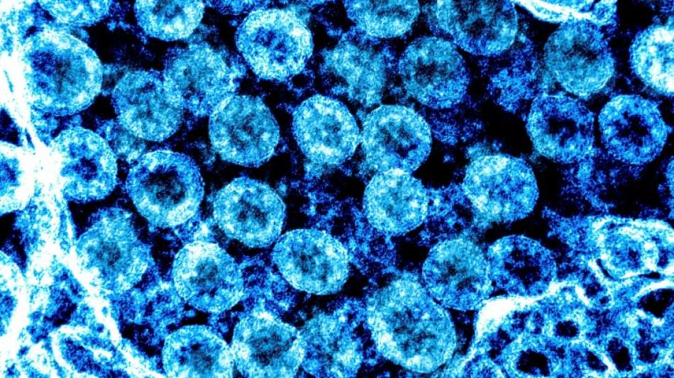 Britische Studien best&auml;tigen minderschwere Erkrankungen bei Omikron-Infektionen