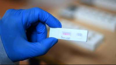 St&auml;dte- und Gemeindebund warnt vor zu hohen Erwartungen an Corona-Schnelltests