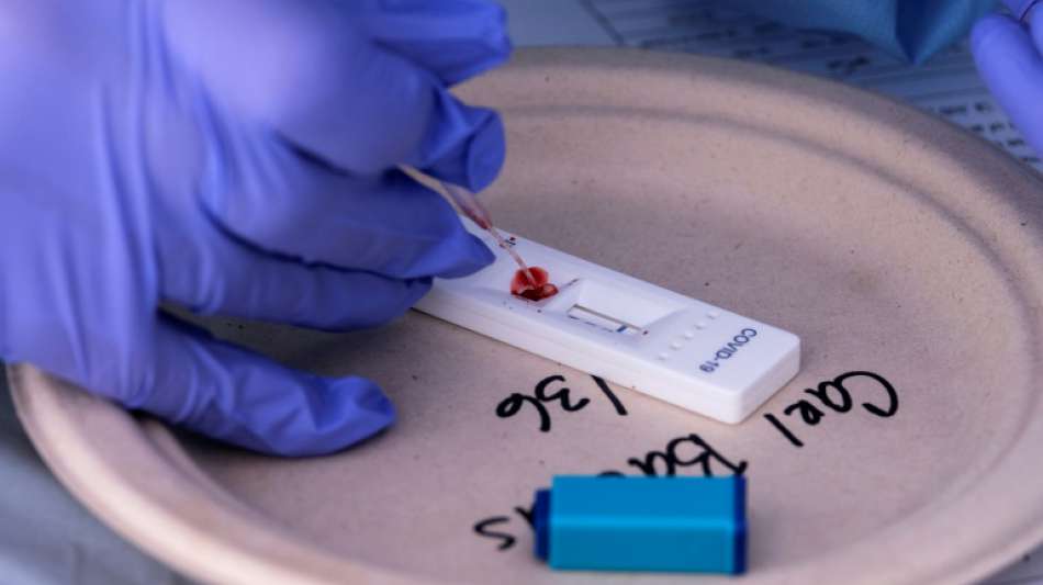 Corona-Schnelltests sollen f&uuml;r &auml;rmere L&auml;nder k&uuml;nftig nur noch die H&auml;lfte kosten