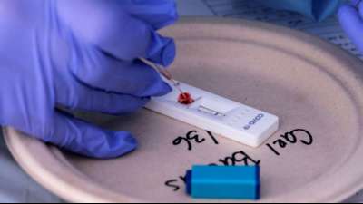 Corona-Schnelltests sollen f&uuml;r &auml;rmere L&auml;nder k&uuml;nftig nur noch die H&auml;lfte kosten