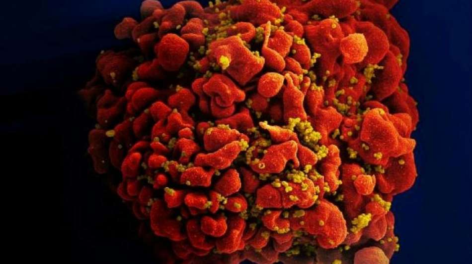 Studie: mRNA-Impfstoff gegen HIV in Tierversuchen "vielversprechend"