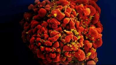 Studie: mRNA-Impfstoff gegen HIV in Tierversuchen "vielversprechend"