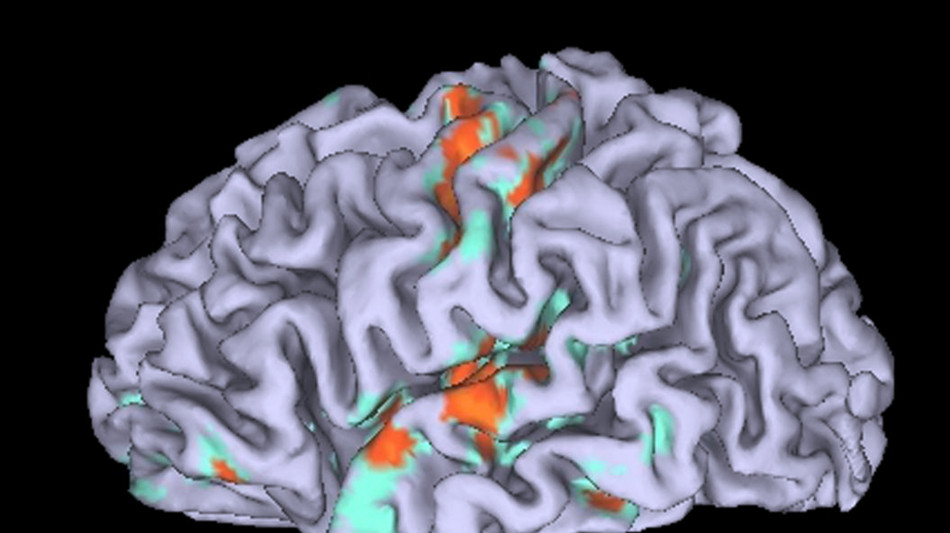 La menopausa cambia il cervello in modo diverso da pubert&agrave; e gravidanza