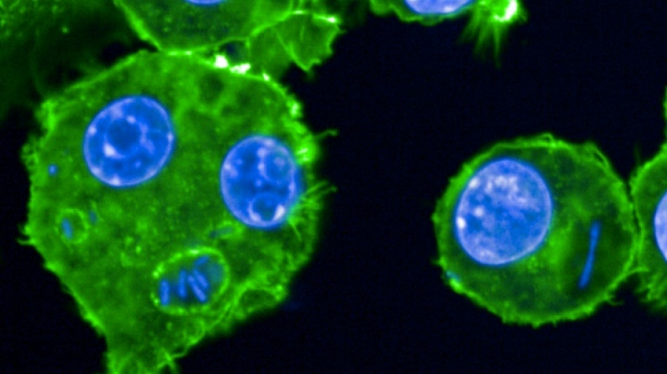 Peste, l&egrave;pre... Des chercheurs scrutent les microbes du pass&eacute;