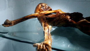 &Ouml;tzi, el "hombre de las nieves" ten&iacute;a piel oscura y calvicie