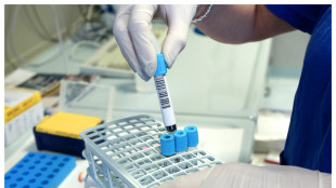 Un ormone aiuta i tumori frenando il sistema immunitario