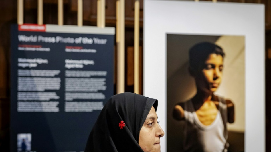 Imagem de menino palestino amputado ganha o World Press Photo