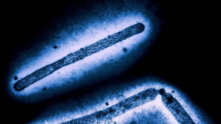 US-Medien: Landwirtschaftsministerium entl&auml;sst versehentlich Vogelgrippe-Beauftragte