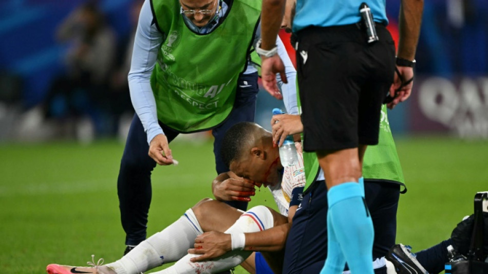 Euro-2024: Kylian Mbapp&eacute; "demeure incertain" pour le match France-Pays-Bas de vendredi (FFF)