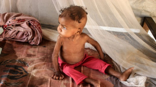 Con 3 años y 4 kilos, una niña al filo de la muerte en Yemen