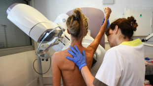 Les mammographies recommandées dès 40 ans aux Etats-Unis 