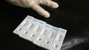 Oms, metà delle diagnosi di Hiv in Europa arriva troppo tardi