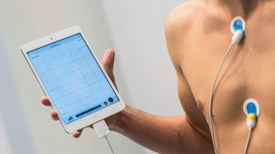 Malattie del cuore, al Sud meno cure e più anni di vita persi