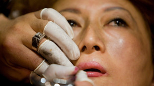 Medicina estetica pi&ugrave; 'gentile', cresce quella preventiva