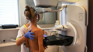 Cancers: la Cit&eacute; des sciences ose l'exploration du "monstre"