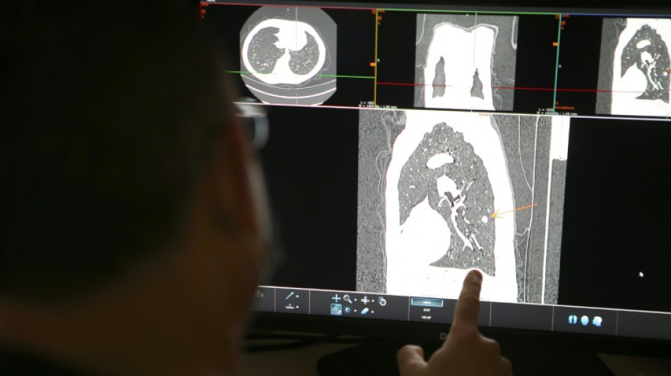 Comprimido reduz pela metade risco de morte por tipo de c&acirc;ncer de pulm&atilde;o