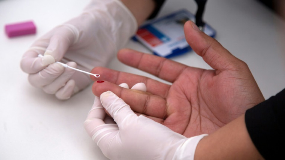 Acuerdo para distribuir gen&eacute;ricos de prevenci&oacute;n del VIH en pa&iacute;ses de bajos ingresos
