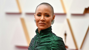 Celebridades y figuras p&uacute;blicas y su "dolorosa" relaci&oacute;n con la alopecia