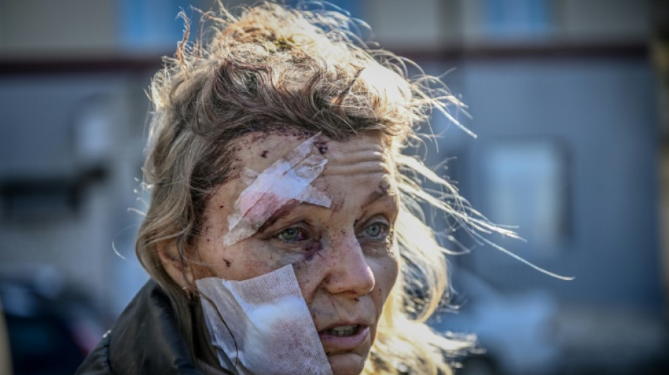 Olena Kurylo, face of the Ukraine war, recalls Russia's invasion