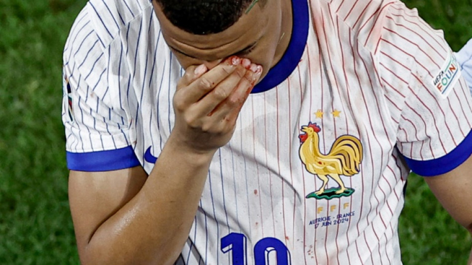 Euro 2024/France: la blessure de Mbapp&eacute;, gros nuage dans le ciel bleu