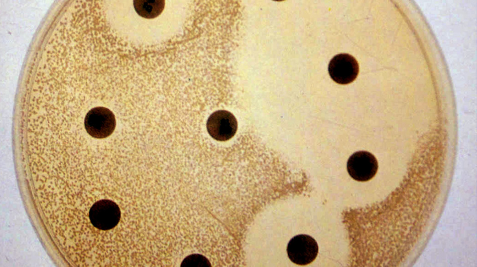 Un anticorpo 'vince' antibiotico-resistenza di un super-batterio