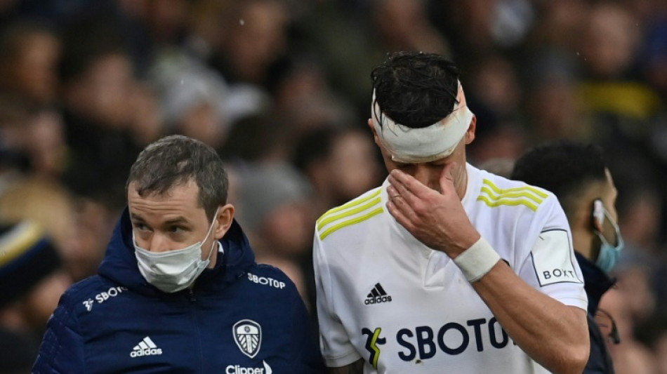 Footballers' union call for temporary concussion substitutes