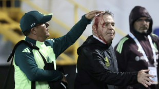 T&eacute;cnico do M&eacute;xico &eacute; ferido na cabe&ccedil;a por torcedores em derrota para Honduras