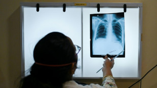 WHO: Weniger Todesfälle durch Tuberkulose dank mehr Diagnostik und Behandlung